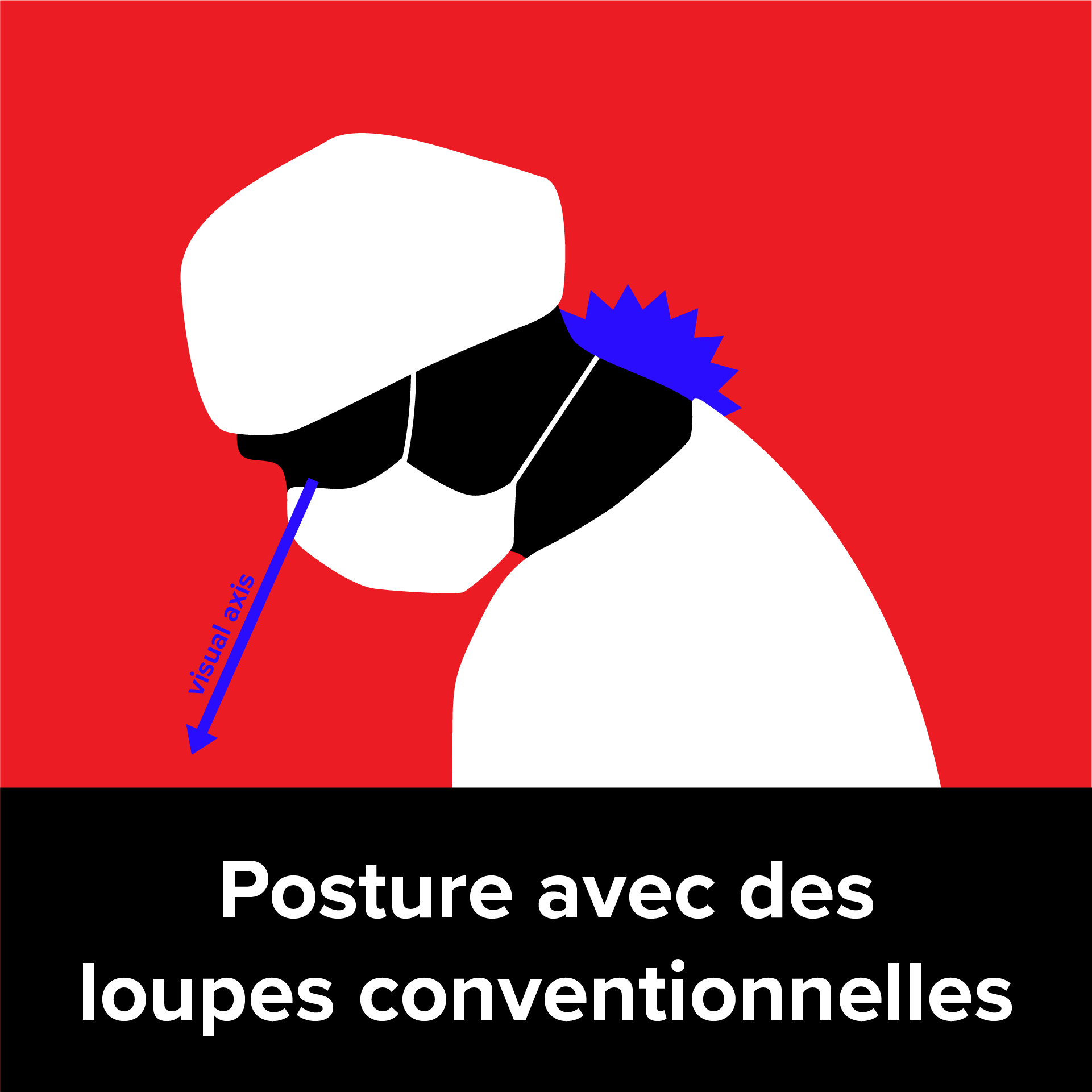 posture wearing conventional loupes