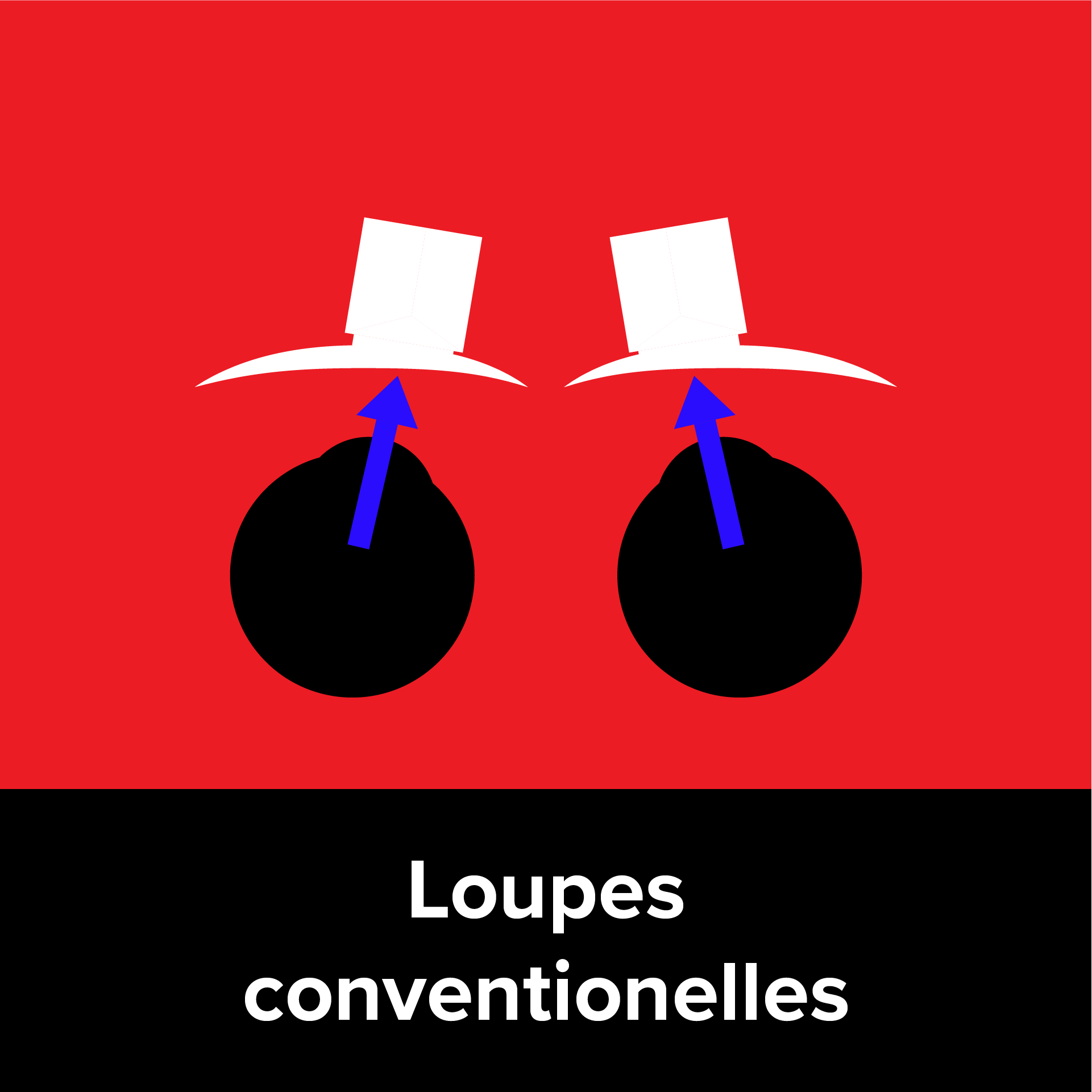 Conventional Loupes