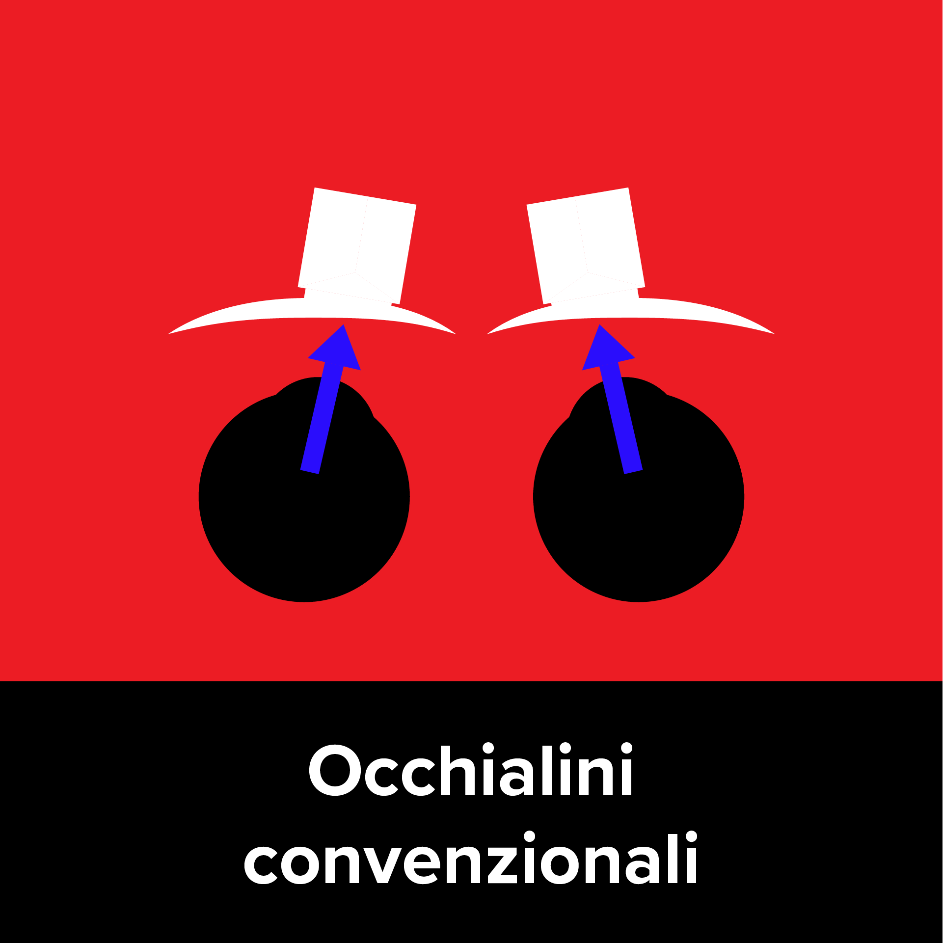 Conventional Loupes