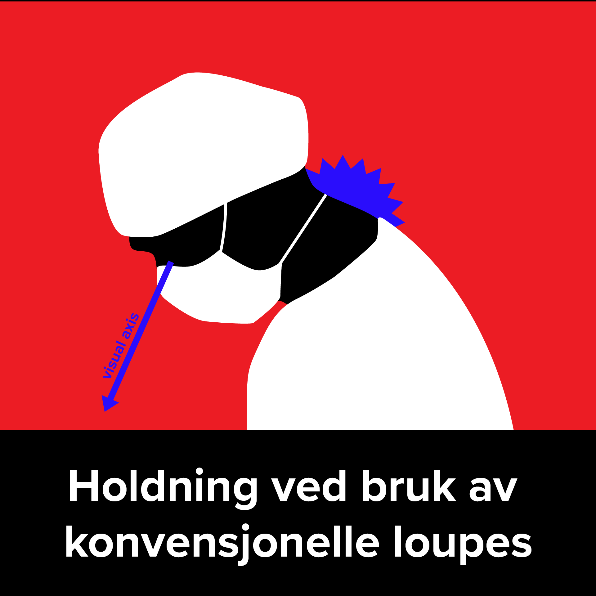 posture wearing conventional loupes