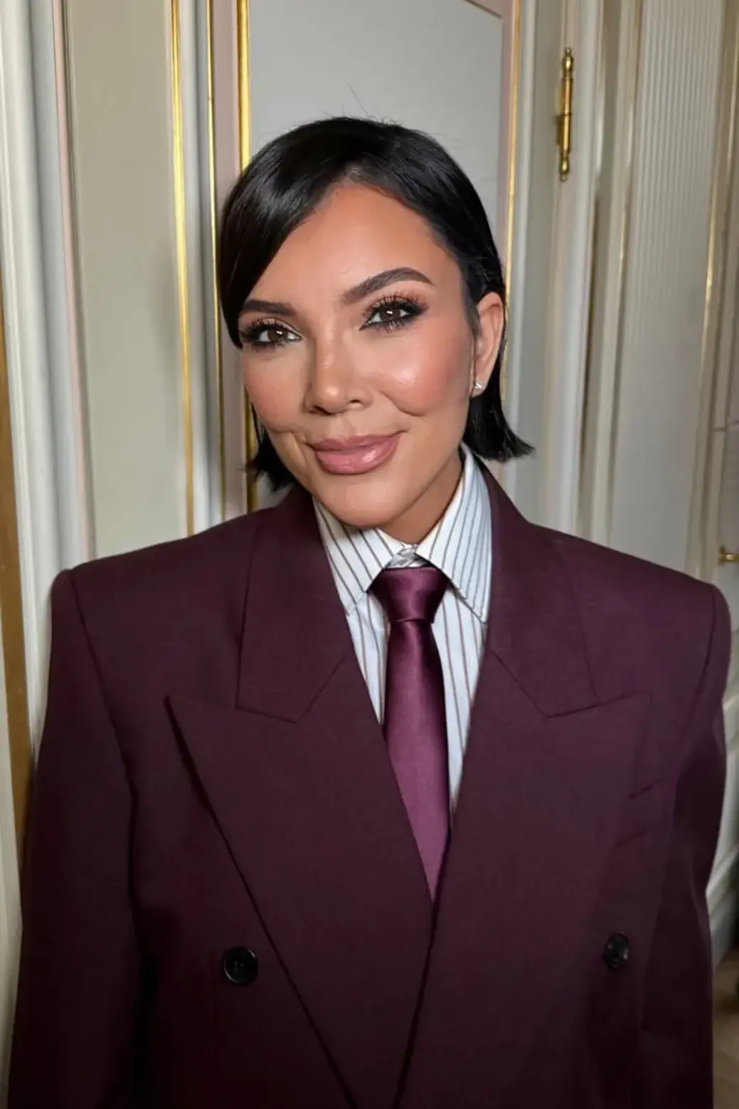 Kris Jenner before and after deep plane facelift