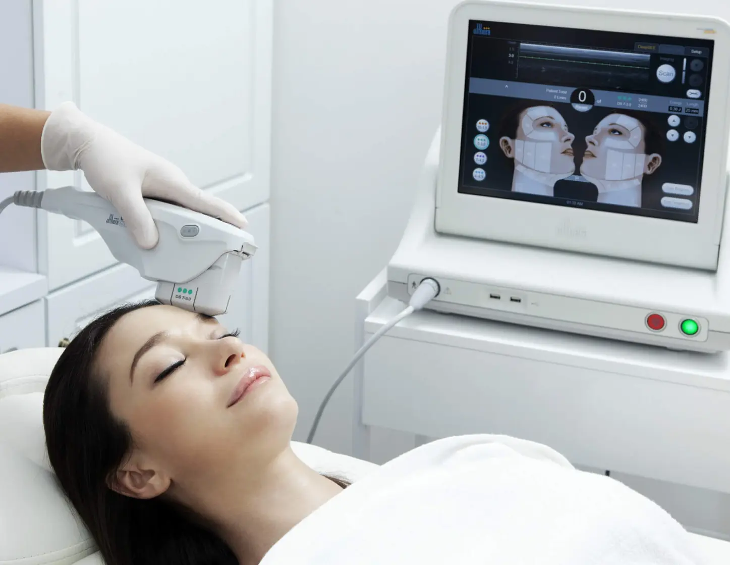 Ultherapy treatment