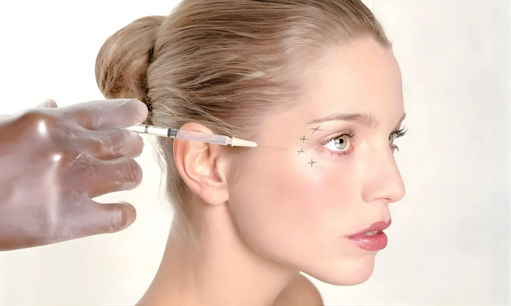 Baby Botox Baby Botox