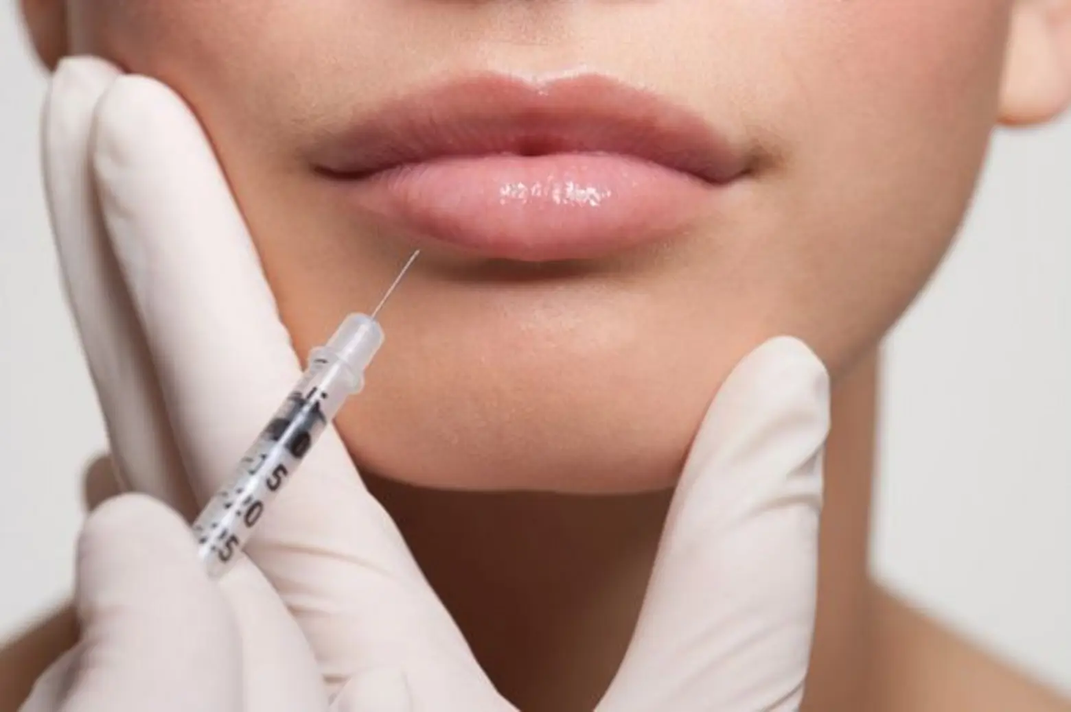 Lip lift Injection