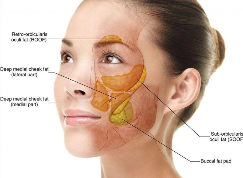 The Price of Buccal Fat Removal 4 The Price of Buccal Fat Removal 4