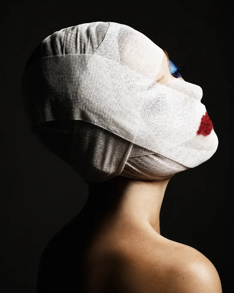 The Price of Buccal Fat Removal 0 The Price of Buccal Fat Removal 0