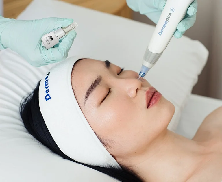Dermapen 4 Exosome Skincare: Four Rules Before You Buy or Book 0
