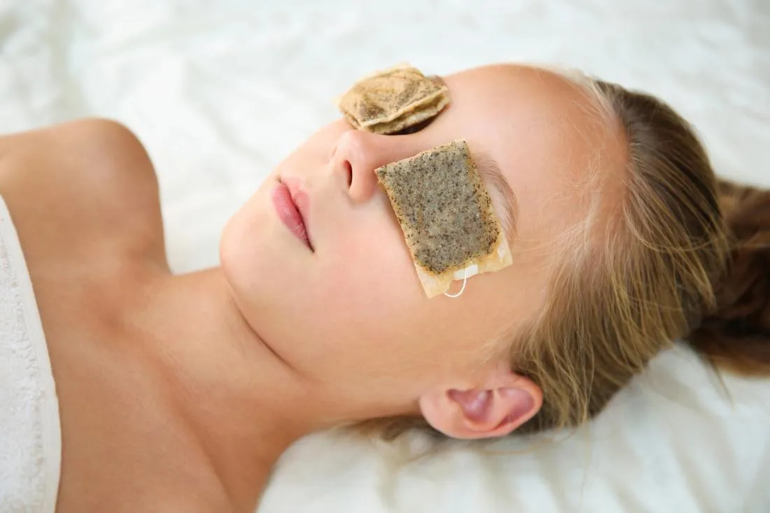 Tea-soaked tissue: a simple trick for de-puffing eye care routine Tea-soaked tissue: a simple trick for de-puffing
