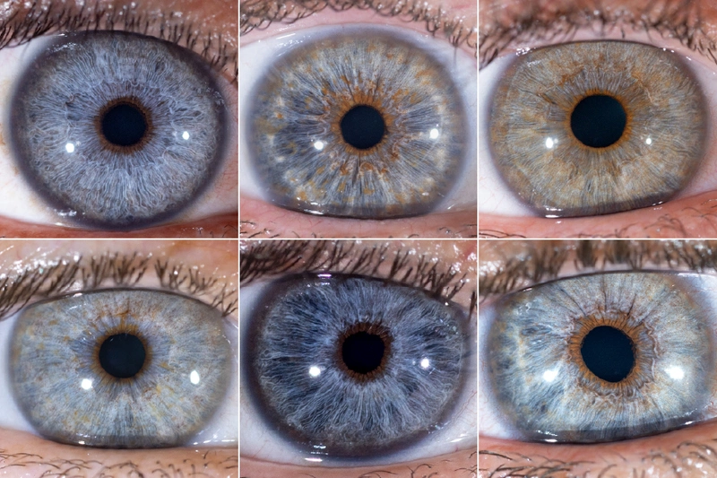 Eyecos Clinic Eye Color Surgery 0