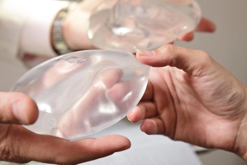 Silicone gel breast implant prostheses Breast Implant Removal Created Its Own Aesthetic Market 1