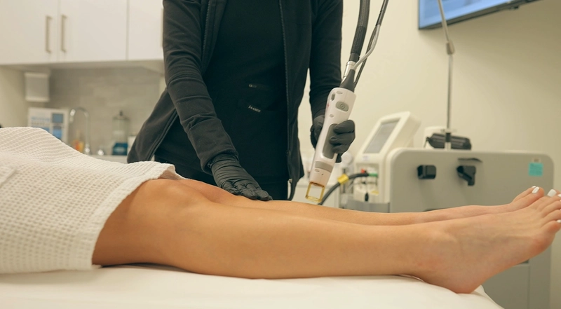 When Did Leg Veins Become A Beauty Problem? 1