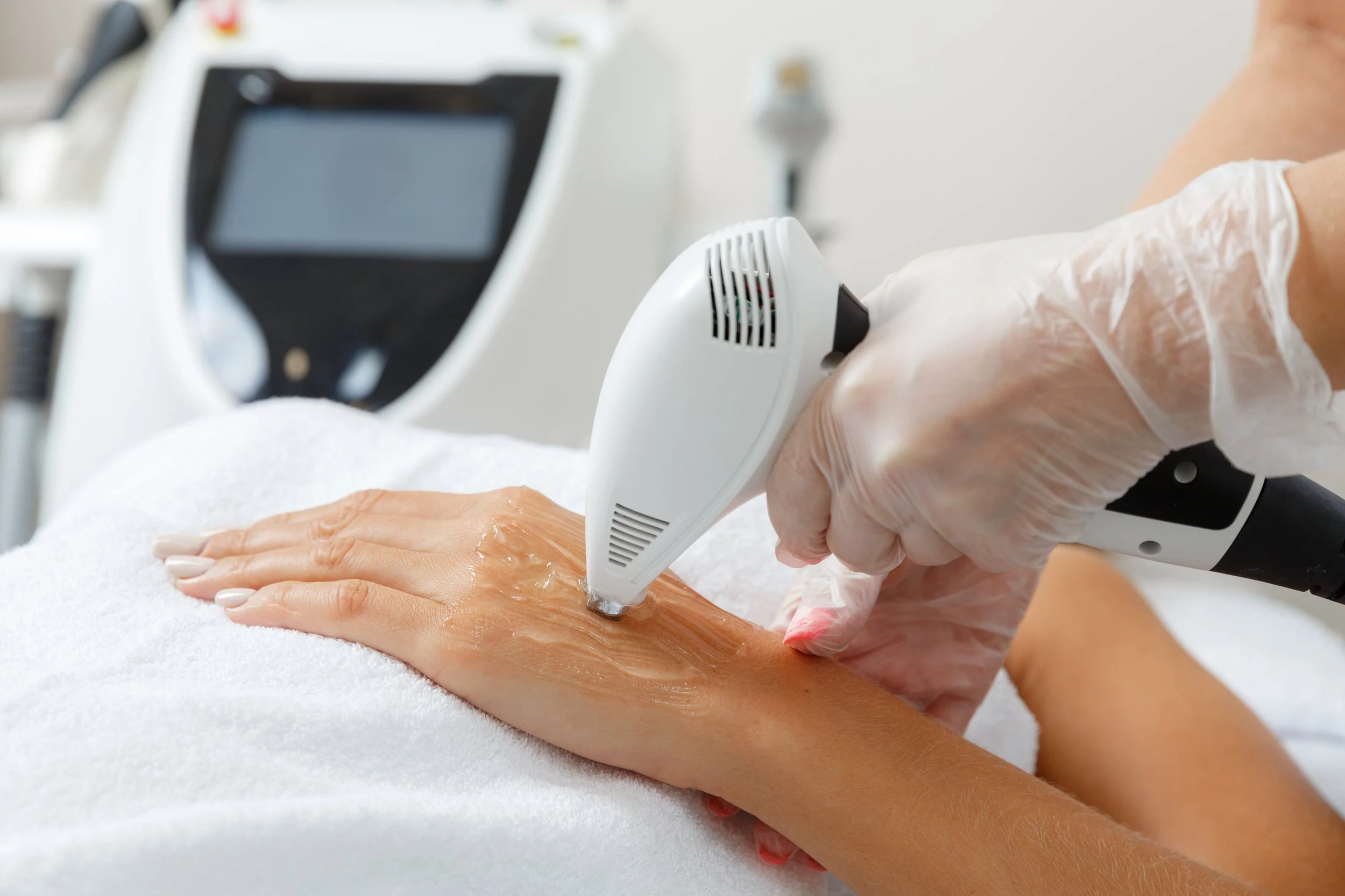 Why Hands Became an Anti-Aging Blind Spot 6