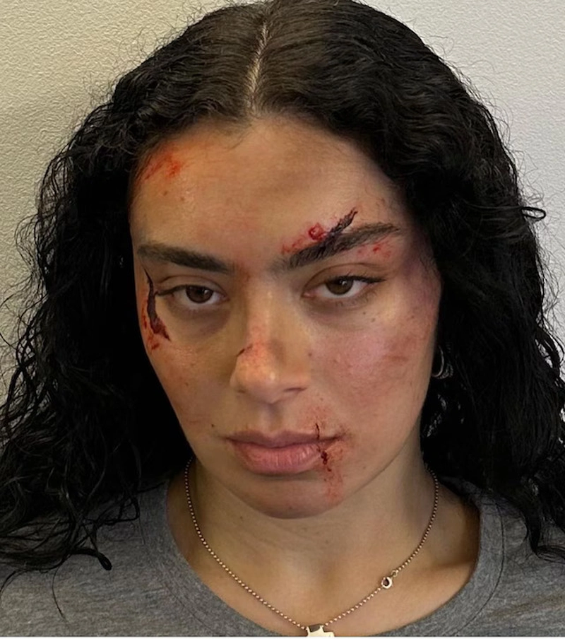 Bruised Makeup  7