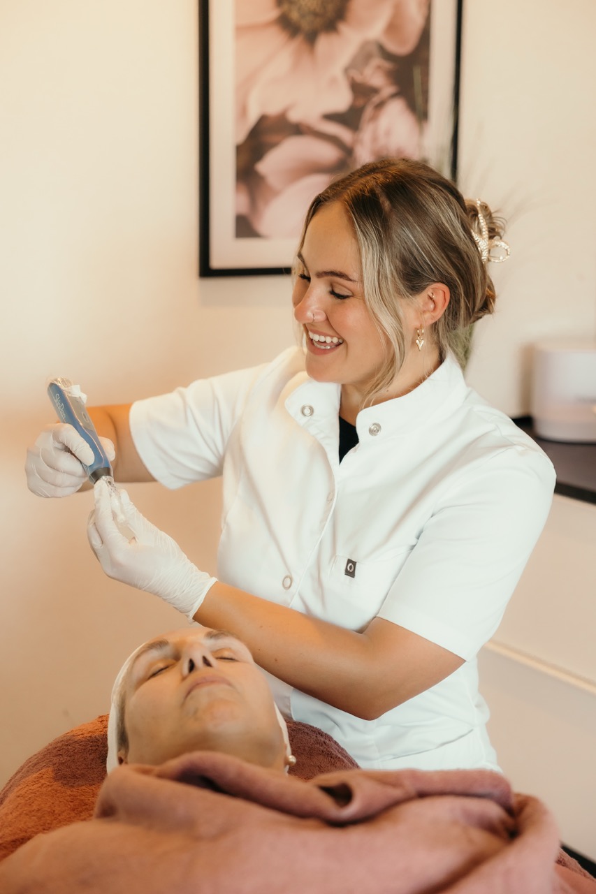 microneedling behandeling