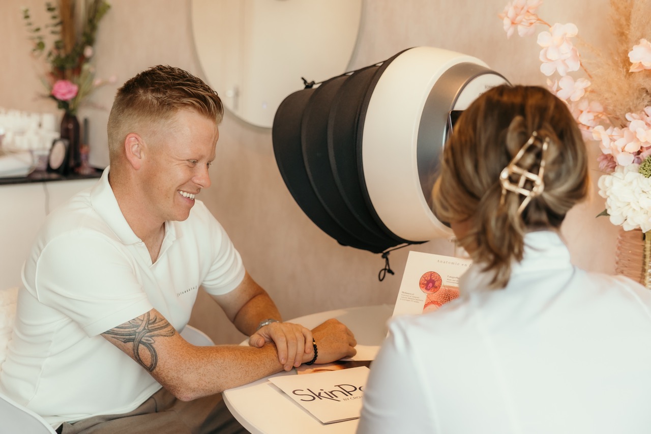 Acne littekens op de huid