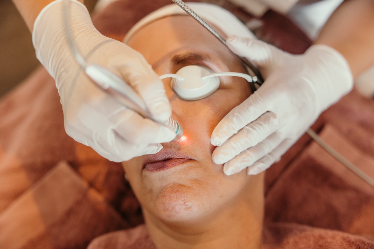 Vaatlaser behandeling