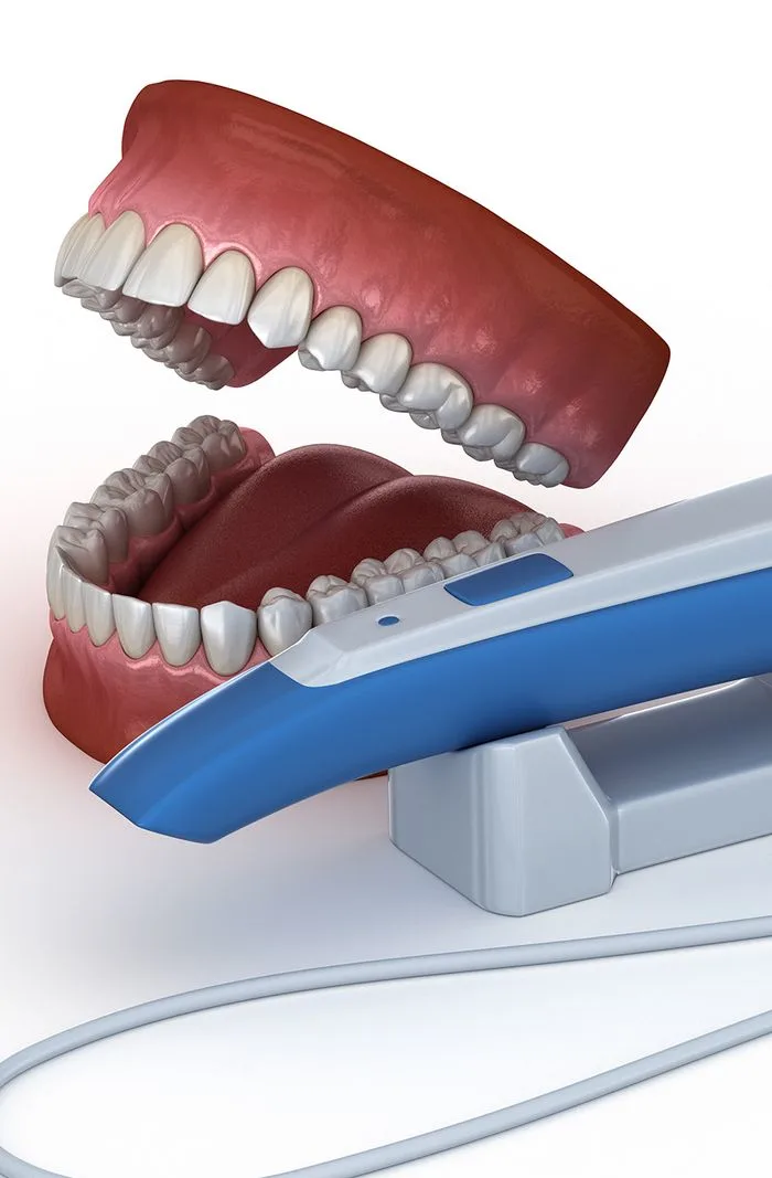 Intraoral Scanner = Mess-Free Treatment