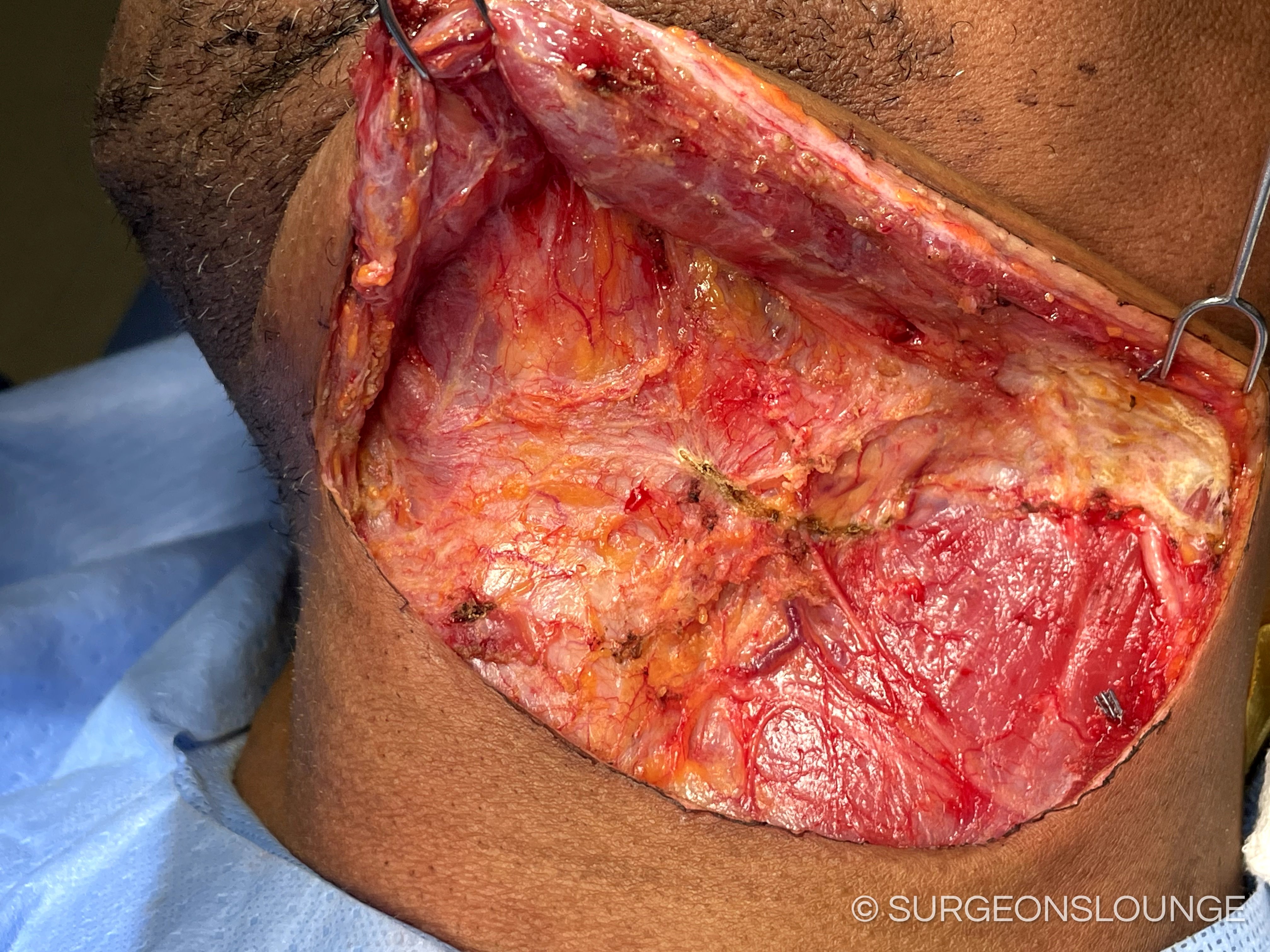 A close up of a person's chestDescription automatically generated