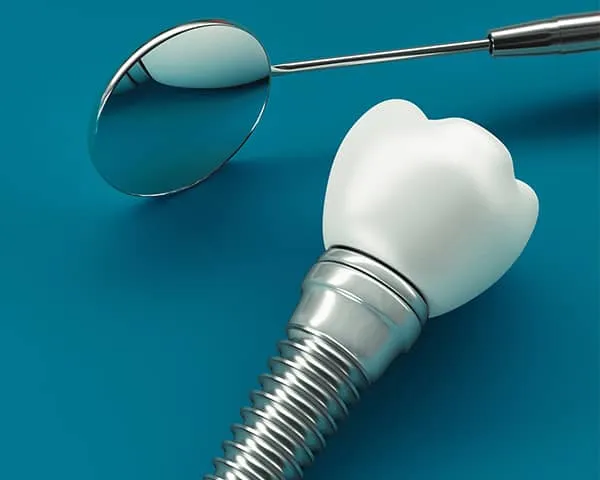 Dental implant next to a dental mirror on a blue surface.
