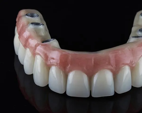 Close-up of a dental prosthesis with artificial teeth and pink gum base, designed for implant attachment.