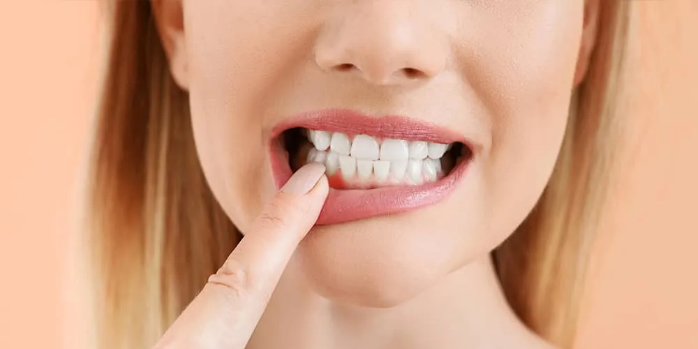Close-up of a woman pointing to her lower gums with a finger, showing healthy white teeth and pink gums.