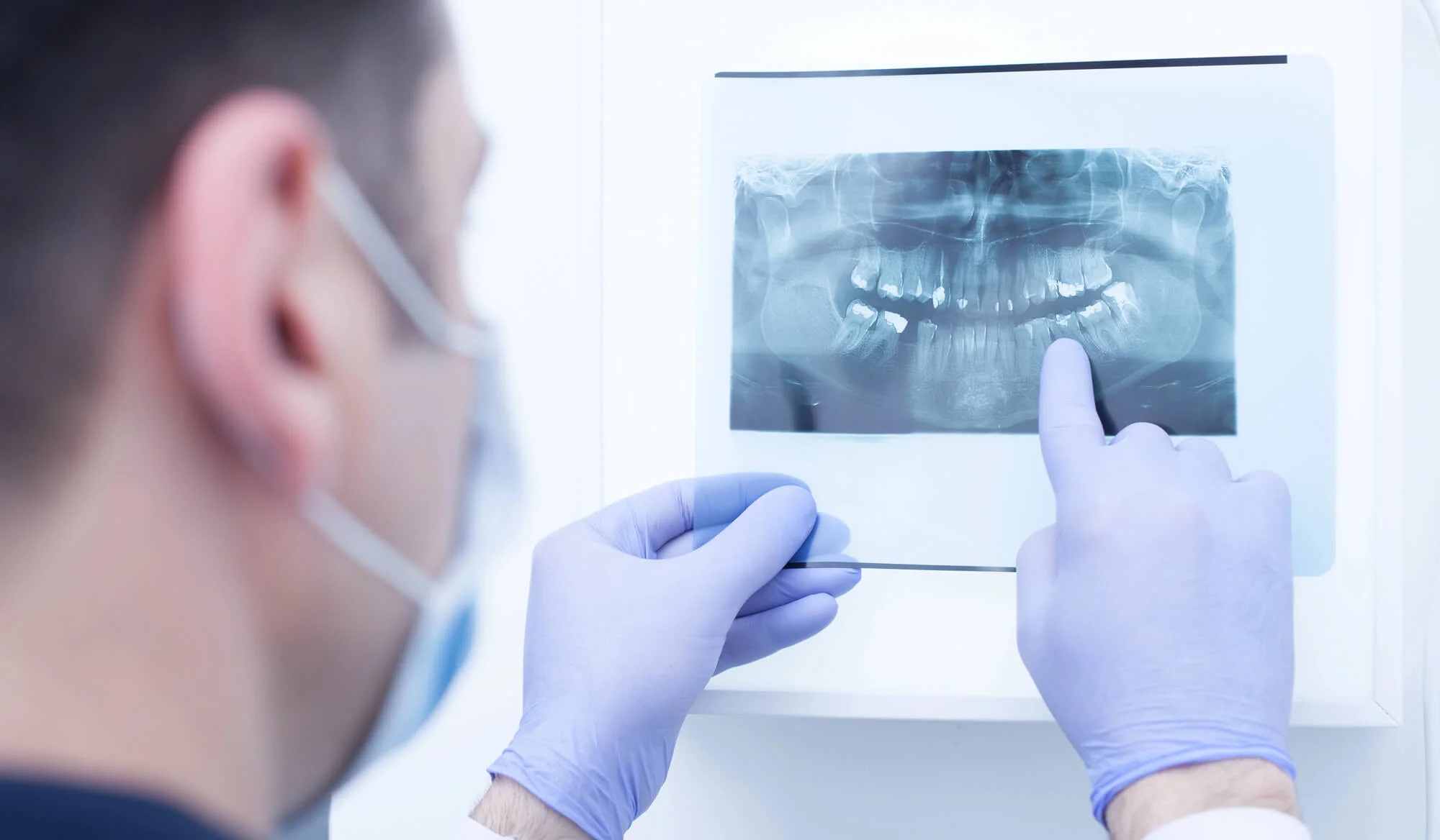  Dentist reviewing panoramic dental x-ray results, dental exams and x-rays.