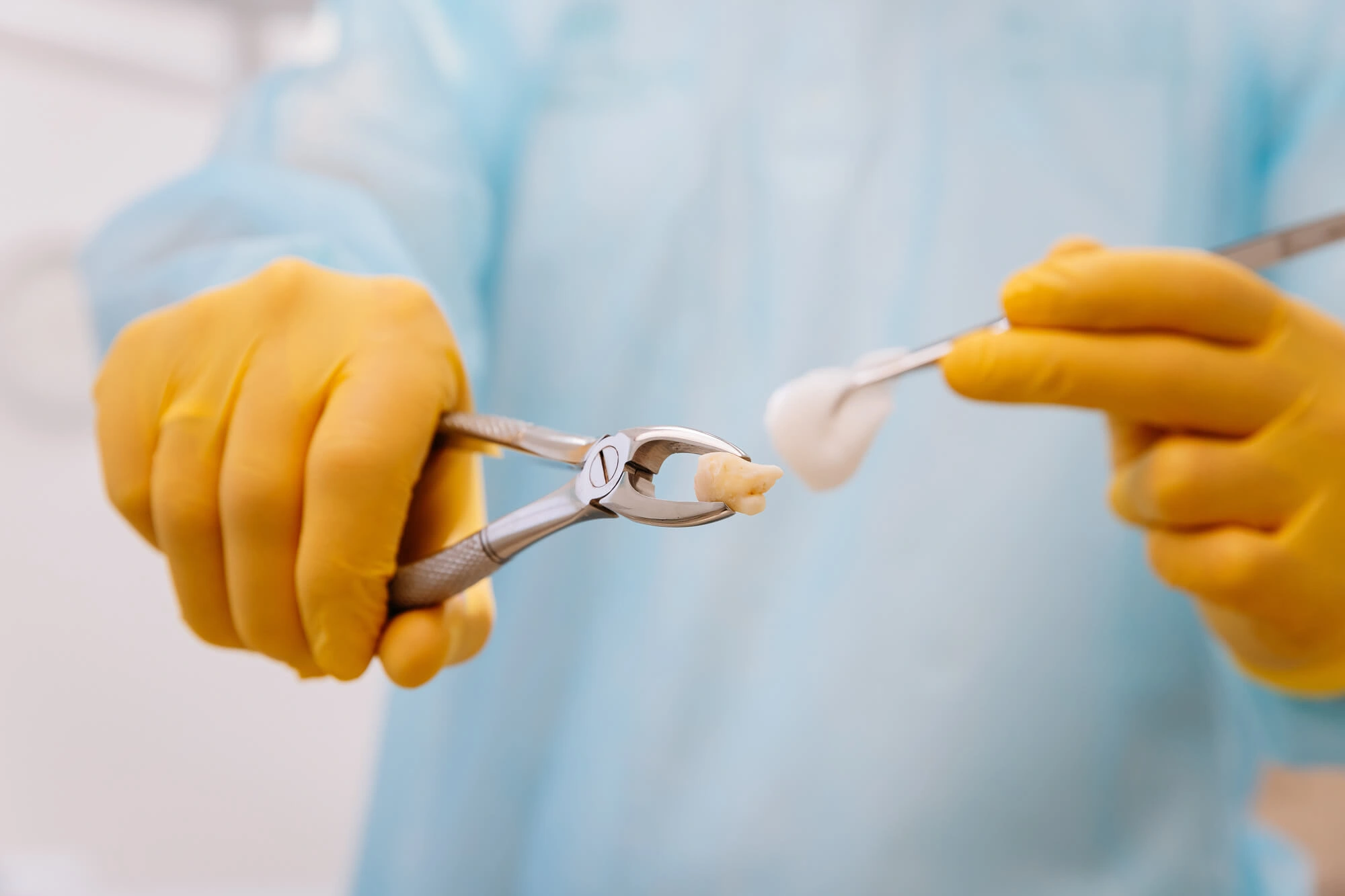 Dentist holding tooth after tooth extraction northport