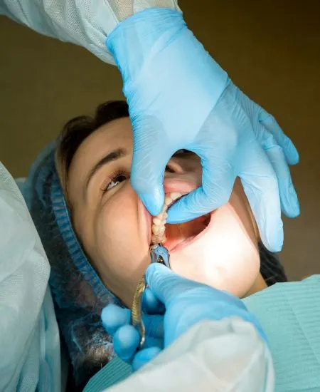 Close-up of a patient receiving a dental curing light procedure, used to harden composite materials during restorative treatments.