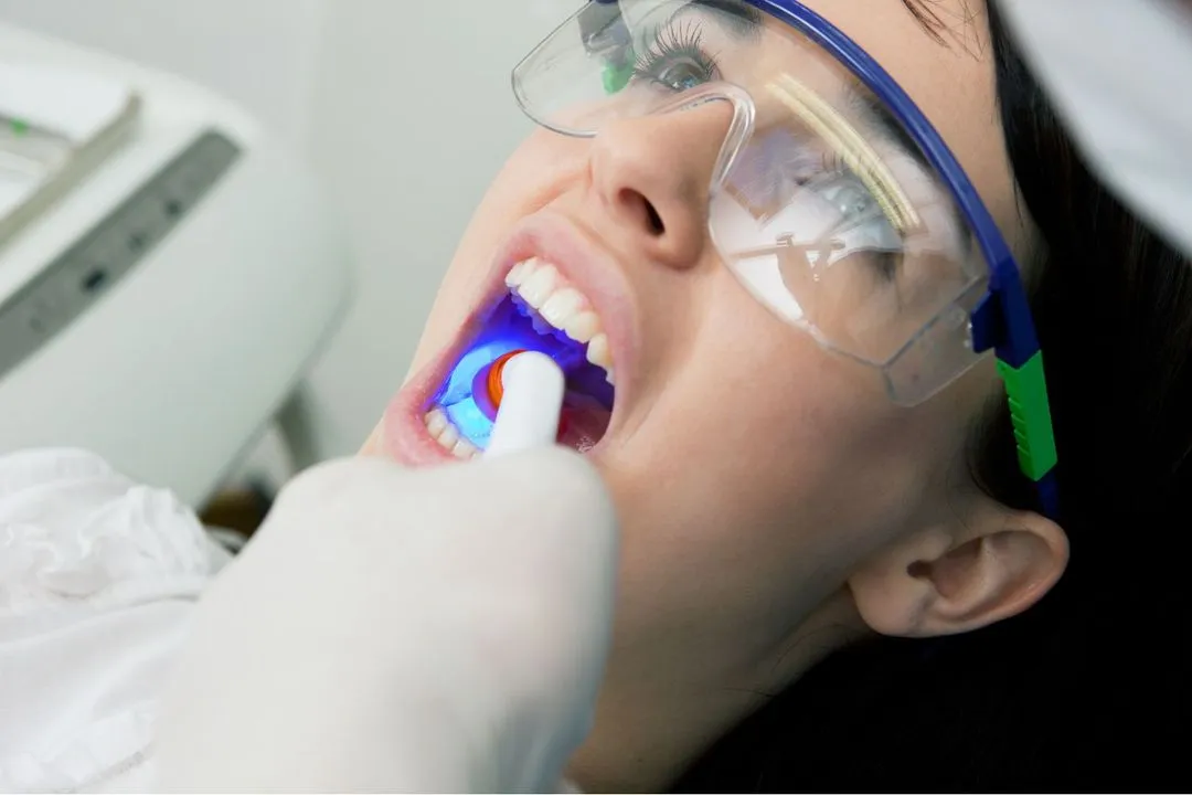 A patient wearing protective eyewear receiving a professional in-office teeth whitening treatment with a blue UV light device.