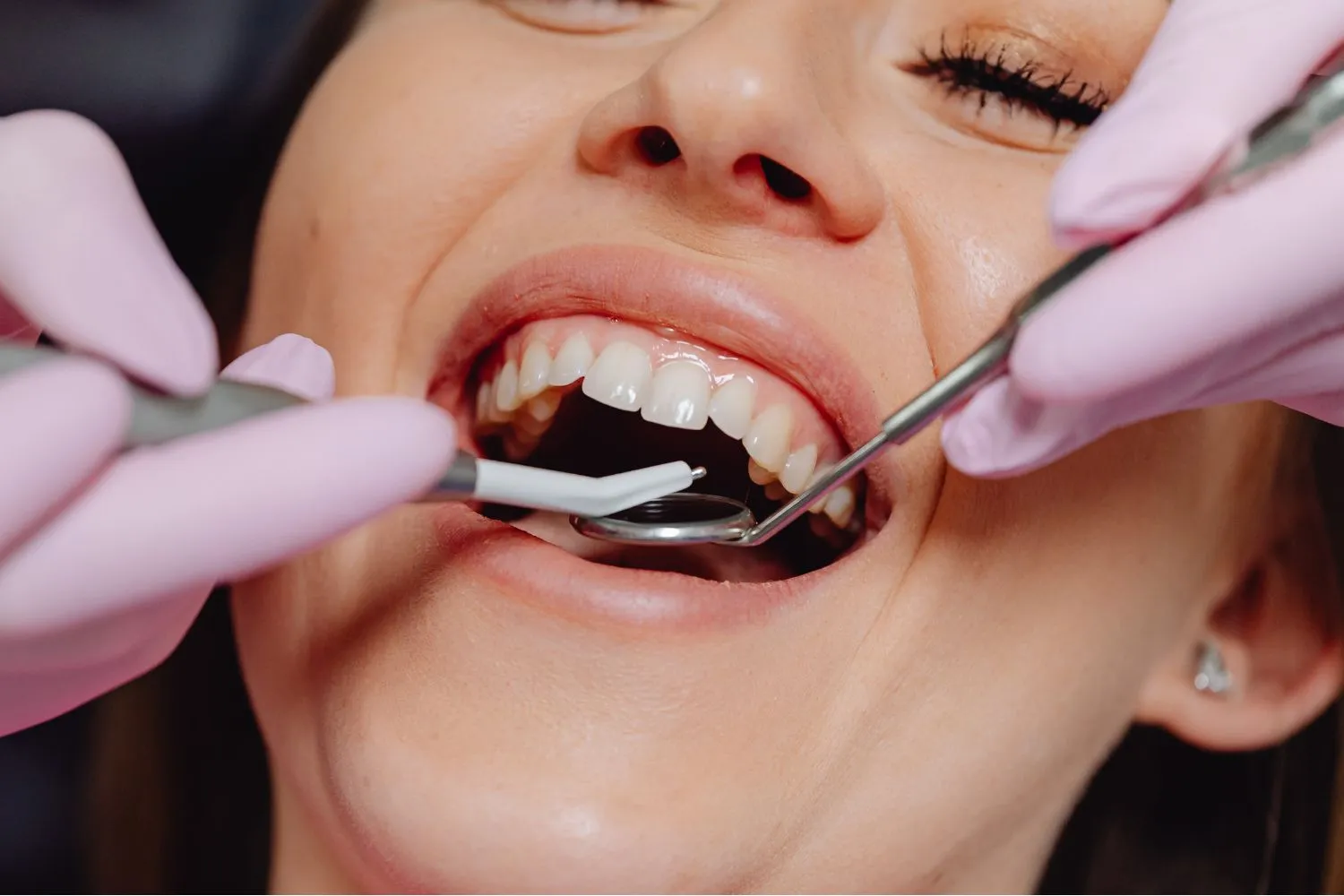 A close-up of a woman receiving a dental examination, showing tools in her mouth as a hygienist checks her teeth and gums.