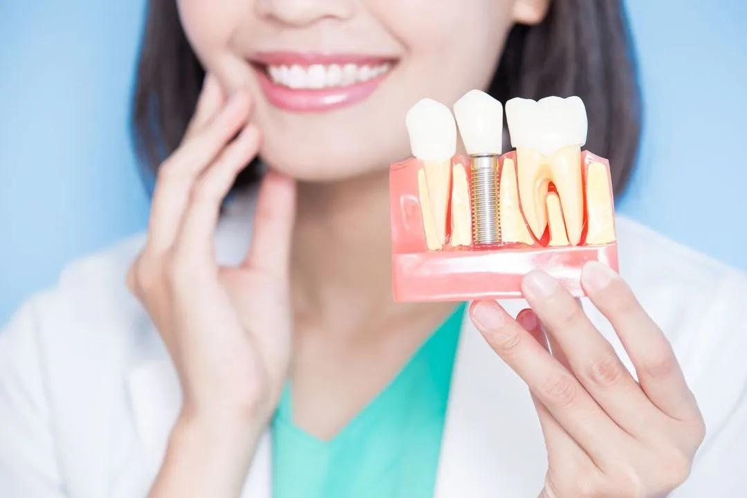 A smiling woman in a lab coat holding a cross-section model showing the internal structure of dental implants and surrounding gum tissue.