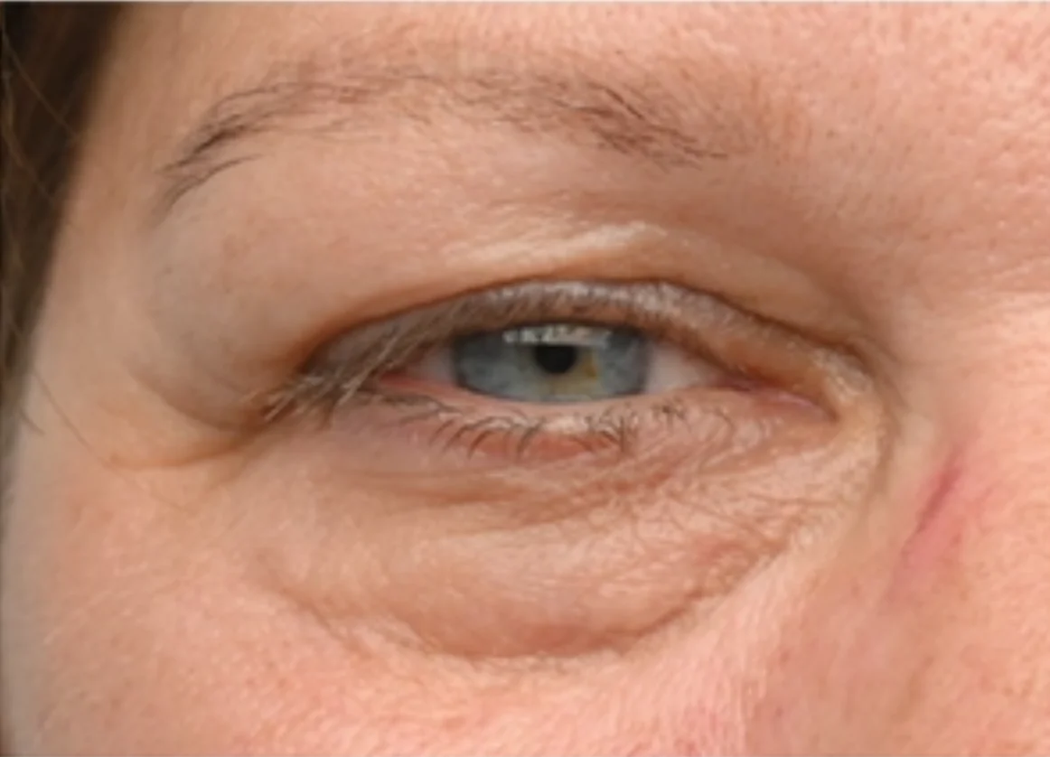 Close-up of a blue eye with visible wrinkles and fine lines around it.