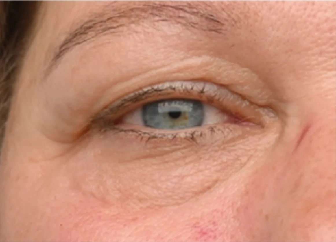 Close-up of a mature human eye with visible wrinkles and light skin.
