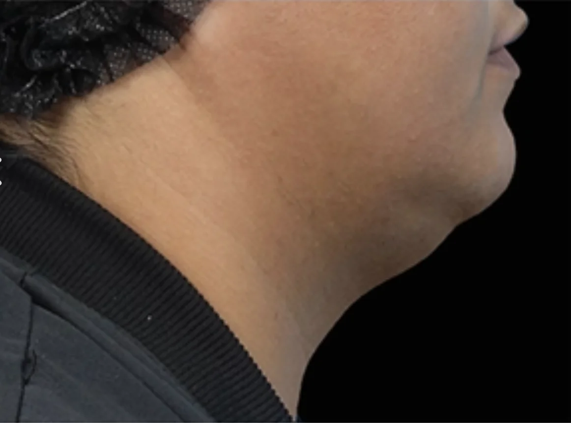 Close-up side view of a person's neck and lower face with a dark garment and black head covering visible.
