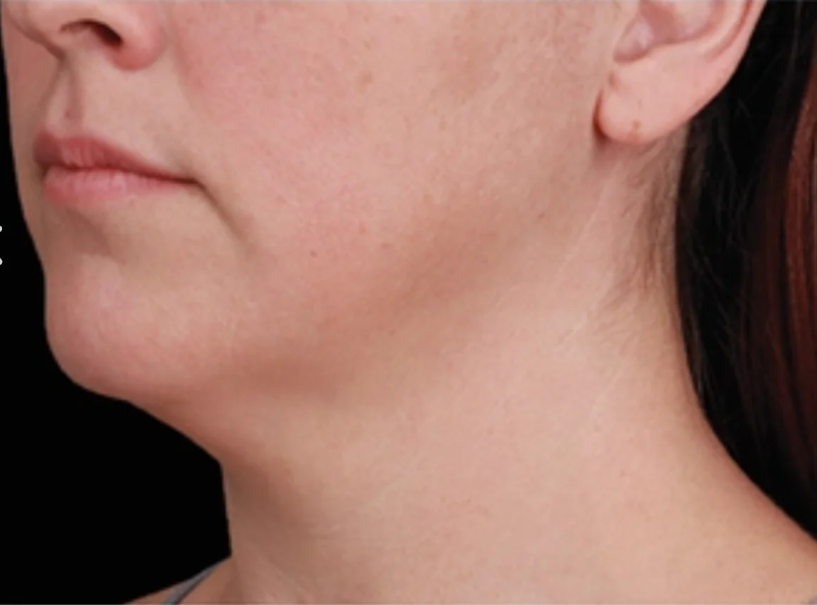 Close-up of the left side of a woman's lower face, showing the jawline, chin, neck, and ear with natural skin texture.