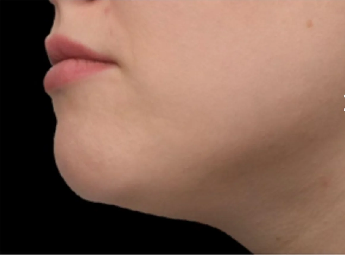 Close-up side profile of a person’s lower face showing the lips, chin, and jawline against a black background.