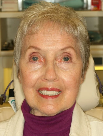 Elderly woman with short light hair smiling, wearing a purple turtleneck and beige jacket.