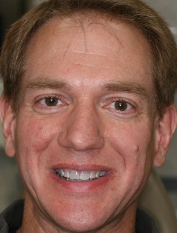 Close-up of a smiling middle-aged man with light brown hair and a small mole on his right cheek.