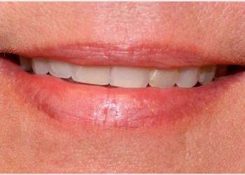 Close-up of a smiling mouth with visible teeth and lips.