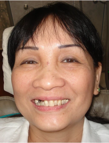 Smiling middle-aged woman with black hair and visible missing tooth, sitting indoors.
