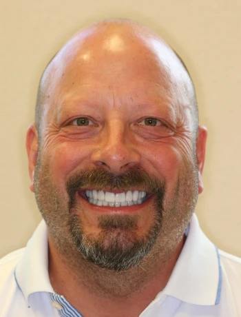 Smiling bald man with a beard and mustache wearing a white collared shirt.