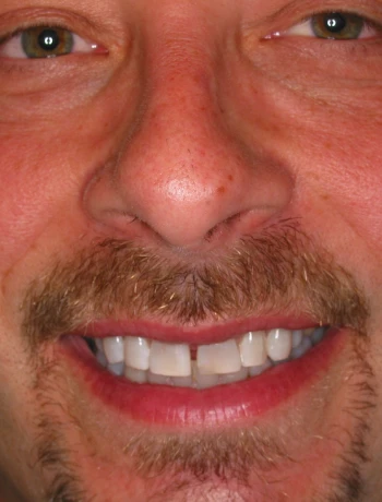 Close-up of a man's face smiling, showing teeth and a mustache with a goatee.