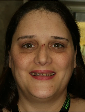 Close-up of a woman with brown eyes, dark hair, and a small cut on her nose smiling slightly indoors.