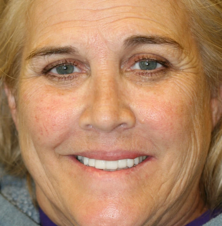 Close-up of a smiling middle-aged woman with green eyes, light skin with freckles, and blonde hair.