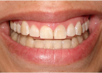 Close-up of a smiling mouth showing healthy upper and lower teeth.