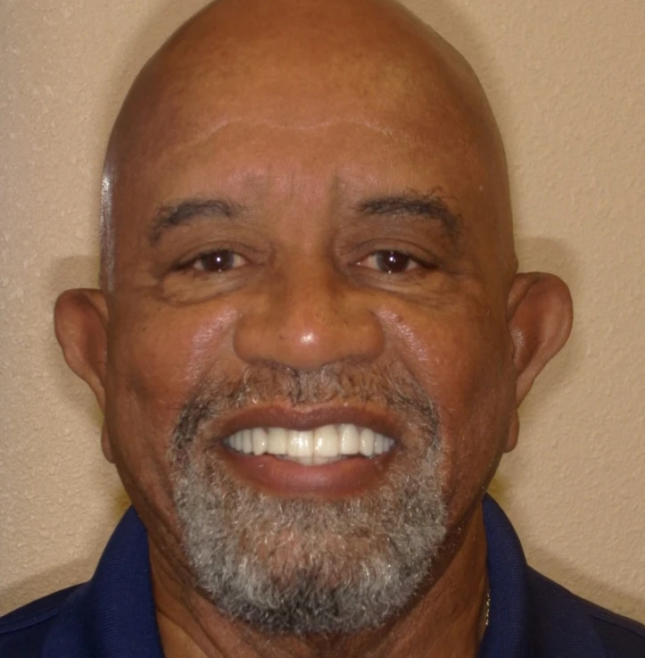 Smiling bald man with gray beard wearing a dark blue shirt against a beige wall.