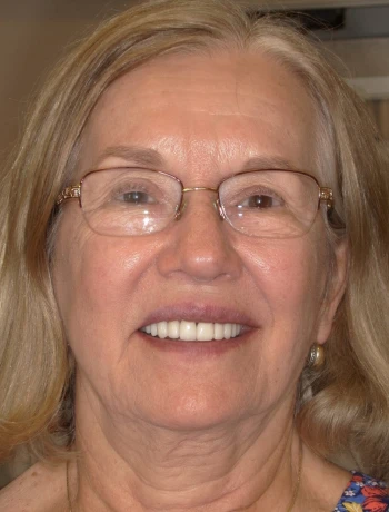 Smiling elderly woman with glasses and long blonde hair wearing a floral top.