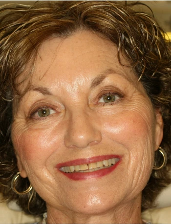 Close-up of a smiling elderly woman with short curly hair and hoop earrings.