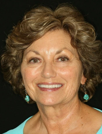 Smiling middle-aged woman with short curly brown hair wearing turquoise earrings and a matching top against a black background.