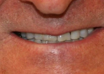 Close-up of a person's mouth with slightly parted lips showing upper teeth and a gap between the front teeth.